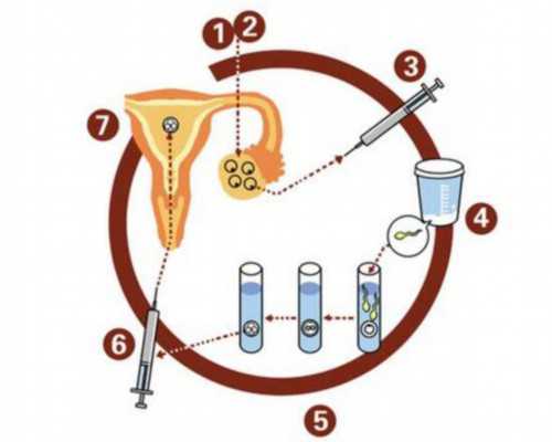 代怀子机构，试管婴儿短方案有哪些步骤？