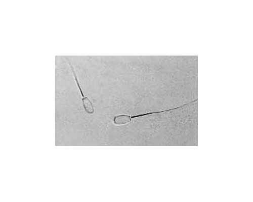 珠海三院建档的详细流程,珠海人类精子库捐精条件和流程