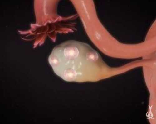 2024珠海不孕不育医院排名,珠海医院检查不孕不育有哪些流程