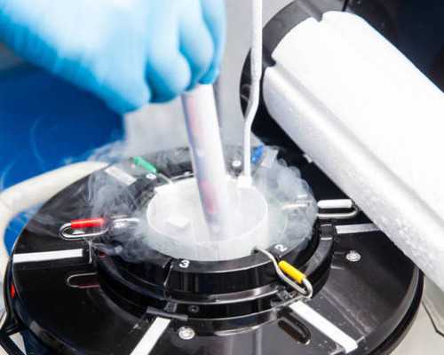 珠海子宫内膜结核哪里查,珠海试管婴儿生男孩成功率总结