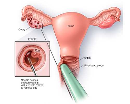 珠海代孕网包成功,珠海妇幼第三代试管婴儿成功率