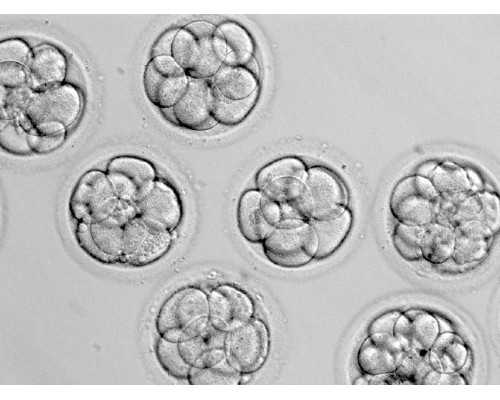 珠海供卵助孕收费,珠海市的月子中心一般要多少钱 月子中心怎么选