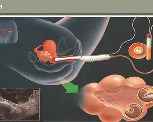 珠海哪里可以冷冻卵子,珠海哪里有看不孕不育比较好的中医