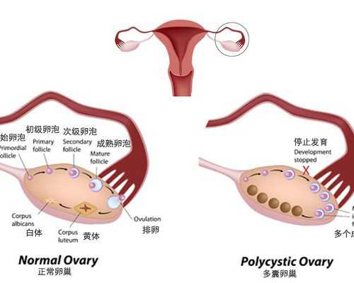 珠海捐卵代怀孕价格,2023珠海三代试管供精生子价格表,已经纳入医保了吗