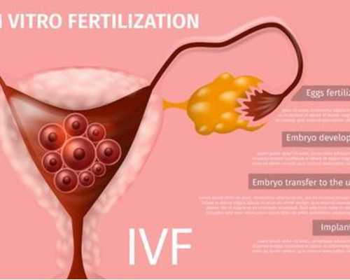 本地助孕机构,治疗不孕不育医院
