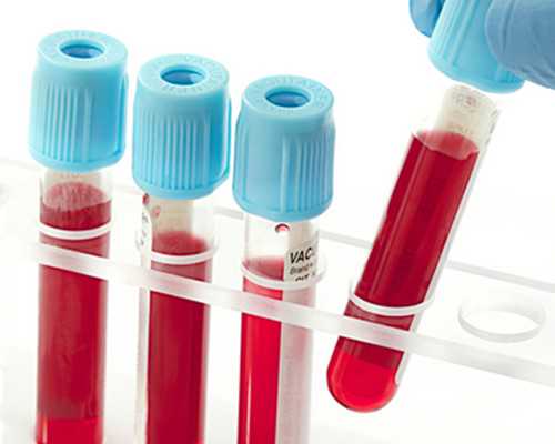 珠海怎样找代生,珠海妇幼试管预约挂号挂号成功有哪些小技巧？