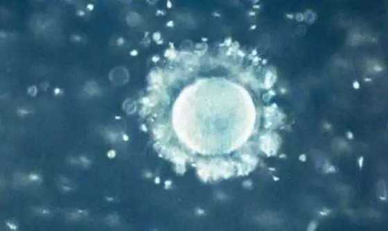珠海供卵试管流程_珠海供卵试管群_「美国试管婴儿」美国试管婴儿卵胞浆内单