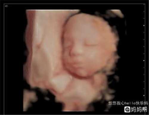 北京供卵代孕价格 北京做供卵试管婴儿的费用因人而异 ‘怀女孩胎囊图’